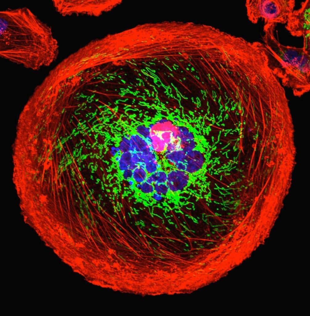 Exosomes Nutra